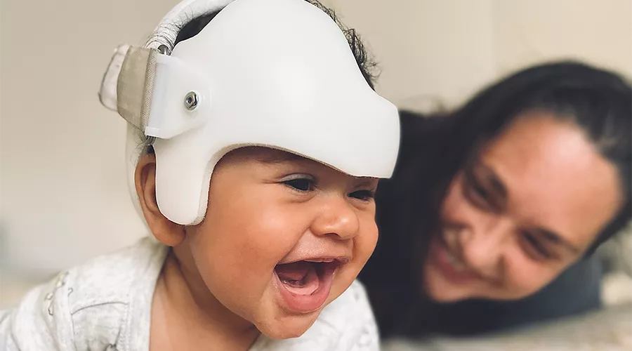 Baby boy in a doc band with his mother