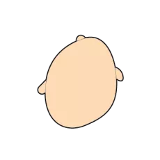 plagiocephaly head shape diagram